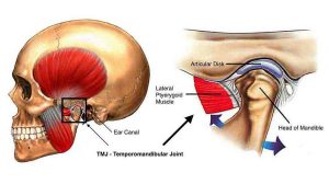 Image of TMJ